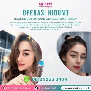 Operasi Hidung