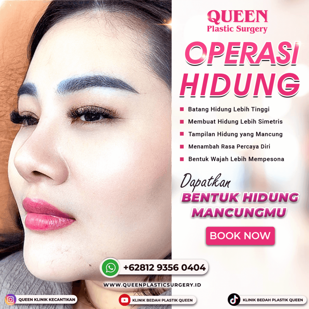 Operasi Hidung Terbaik di Queen Plastic Surgery