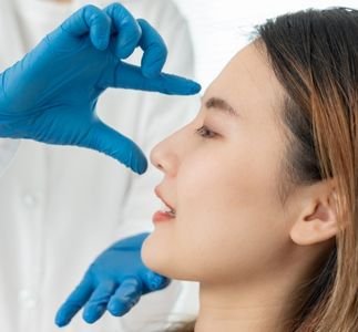 Rhinoplasty